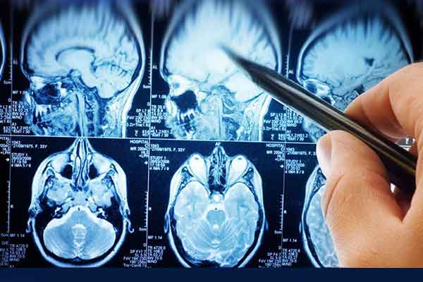 ایستادگی در مقابل اِماِس با ماساژ